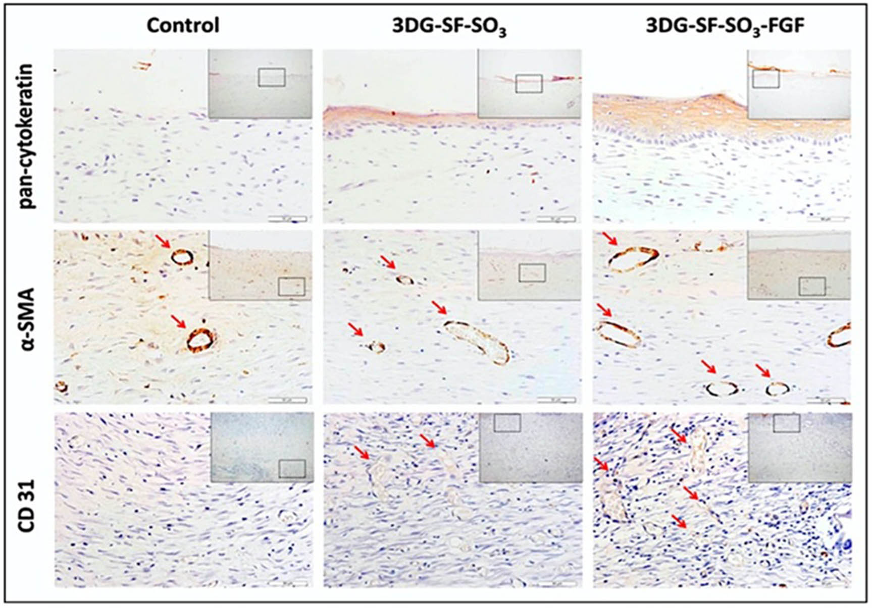 Figure 9 
                  Epidermis and blood vessel formation in skin defects [61].
               