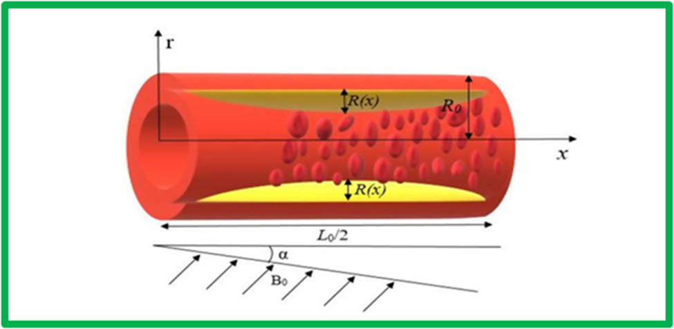Teaser image from the article
