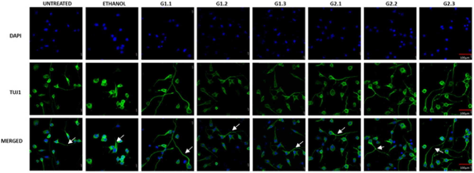 Figure 11 
               Representative confocal pictures of N2A cells after G1 and G2 treatments. TuJ1, stained in green and blue, indicates DAPI, which has marked the nucleus; all photos are at 60× magnification with a scale bar of 10 μm [195].
            