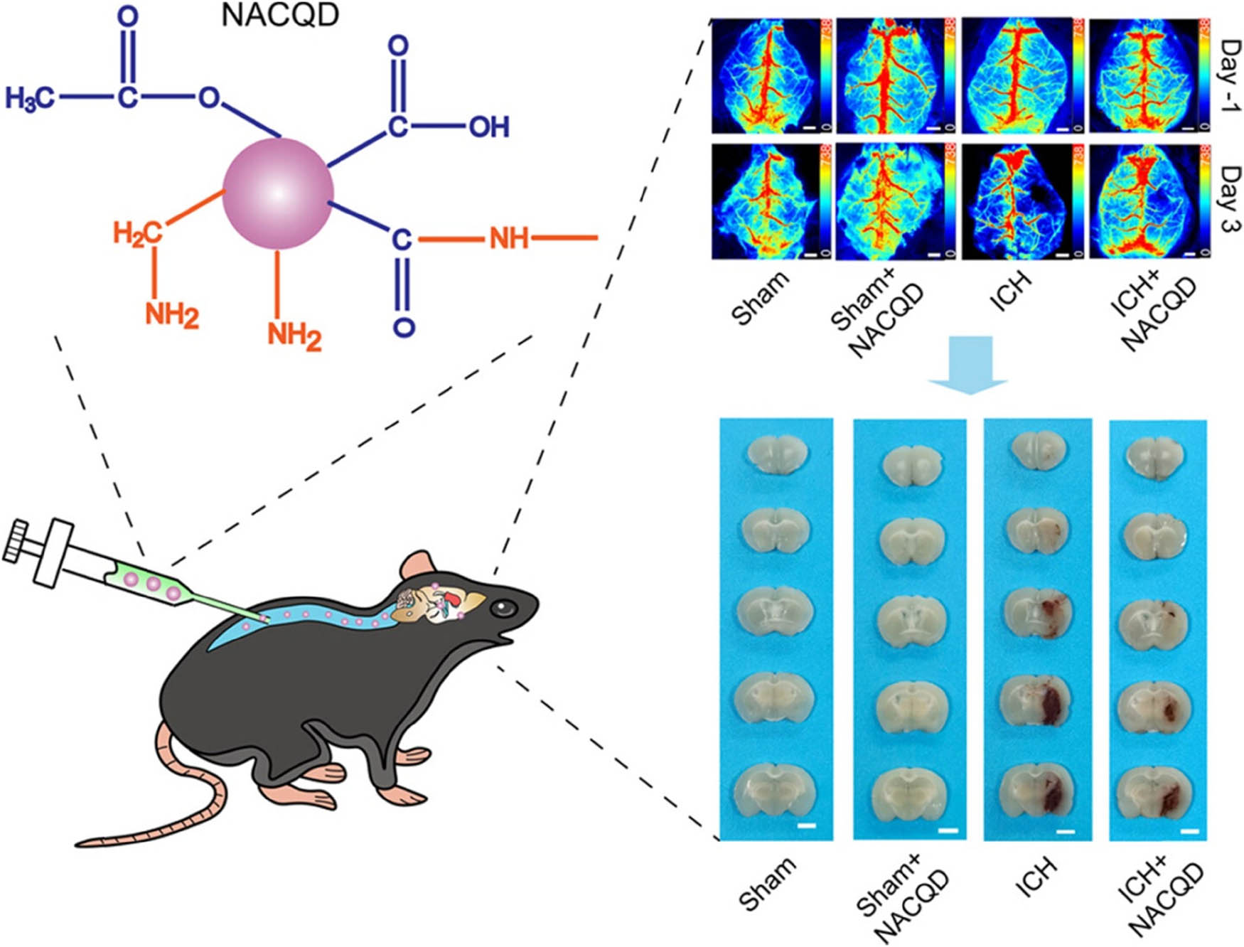 Figure 13 
                  Protective function of NACQD in murine ICH models [214].
               