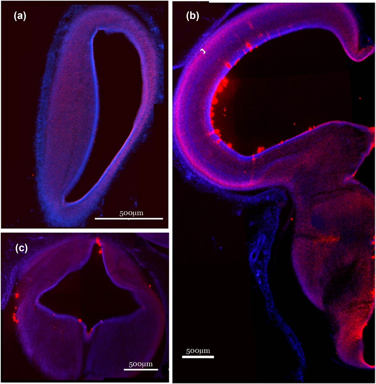 Figure 17 
                  E8 QD-peptide conjugate distribution. E8 embryonic chick brain QD-CL4-JB577 (red) distribution following spinal canal injection at E4. Representative coronal slices (40 μm) of the embryo’s forebrain (a), midbrain (b), and hindbrain (c) demonstrate similar QD distribution at 4 days post-injection (E8). A neuronal layer heavily labeled by QDs is indicated by the bracket in B. In panel B, the small white bracket indicates a neuronal layer that is heavily labeled with QDs.
               