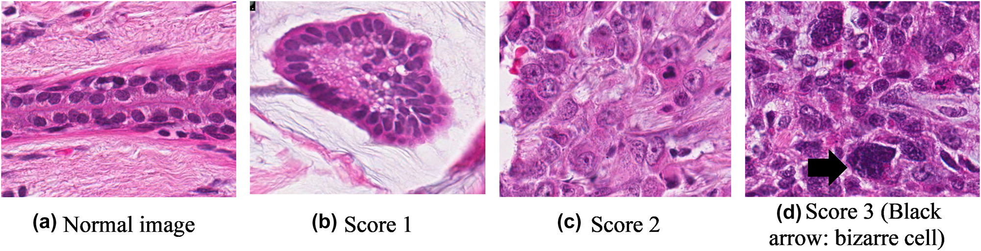 Figure 4: 
Nucleus pleomorphism at different scores.