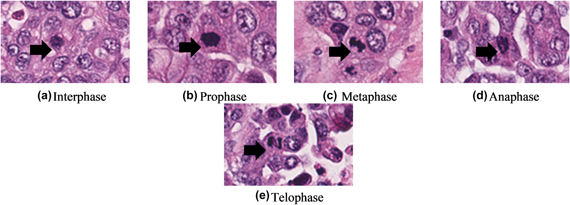 Figure 5: 
Different phases of mitotic cell are shown by the black arrows.