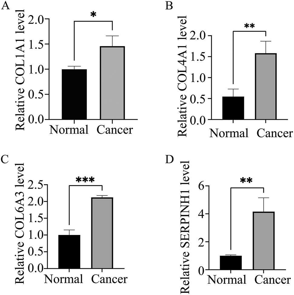Figure 6: 
Five tumor and non-tumor samples selected for RT-qPCR verification. The expression levels of COL1A1 (A), COL4A1 (B), COL6A3 (C), and SERPINH1 (D) in tumor tissues increased compared with noncancerous tissues.
