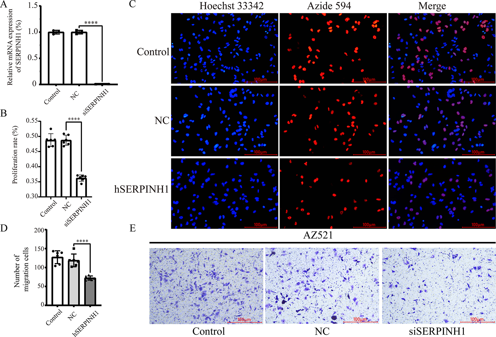 Figure 8: 
SERPINH1 knockdown cell model used to verify the effect of SERPINH1 on GC. (A) RT-qPCR model. (B–C) EdU experiments proving that the knockdown of SERPINH1 inhibited the proliferation of gastric cancer cells. (D–E) Gastric cancer cell migration decreased by the SERPINH1 knockdown in a transwell assay.
