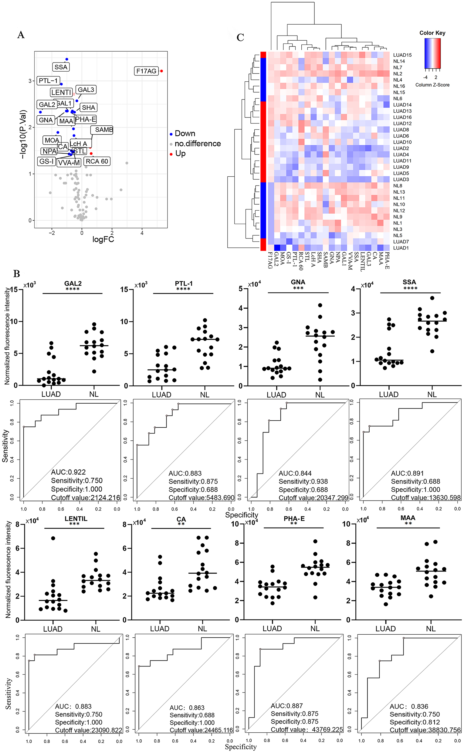 Figure 3: 
The altered plasma glycopatterns among the LUAD and NL groups. (A) Volcano plot of the difference between the LUAD group and the NL group. Red indicates up-regulated lectins, blue indicates down-regulated lectins, and grey indicates insignificant differences. (B) Lectin factors with significantly different signals and ROC analysis of candidate lectins in the LUAD group compared with the NL group, *p≤0.05. (C) The samples are rows, and the 20 candidate lectins are columns. The color and intensity of each square represent the expression level relative to the rest of the data in the row. Red, high, blue, low; white, medium.
