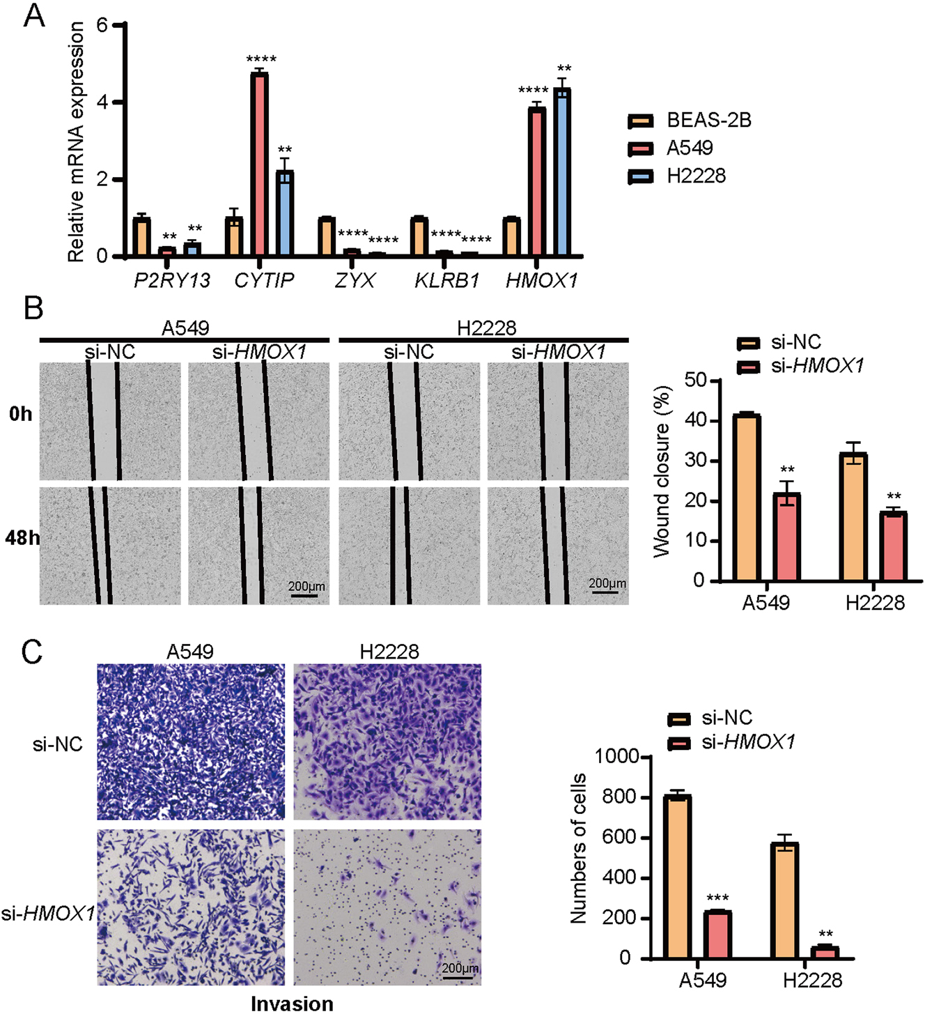 Figure 6: 
The results of in vitro validation experiments for the five key genes. (A) Relative mRNA expressions of P2RY13, CYTIP, ZYX, KLRB1, and HMOX1 in BEAS-2B, A549, and H2228 cells. (B) The impact of HMOX1 silencing on wound healing of A549 and H2228 cells. (C) Effects of HMOX1 silencing on the invasion of A549 and H2228 cells tested via transwell assay. All the experimental data of independent triplicates were expressed as mean±standard deviation. **p<0.01, ***p<0.001, ****p<0.0001.
