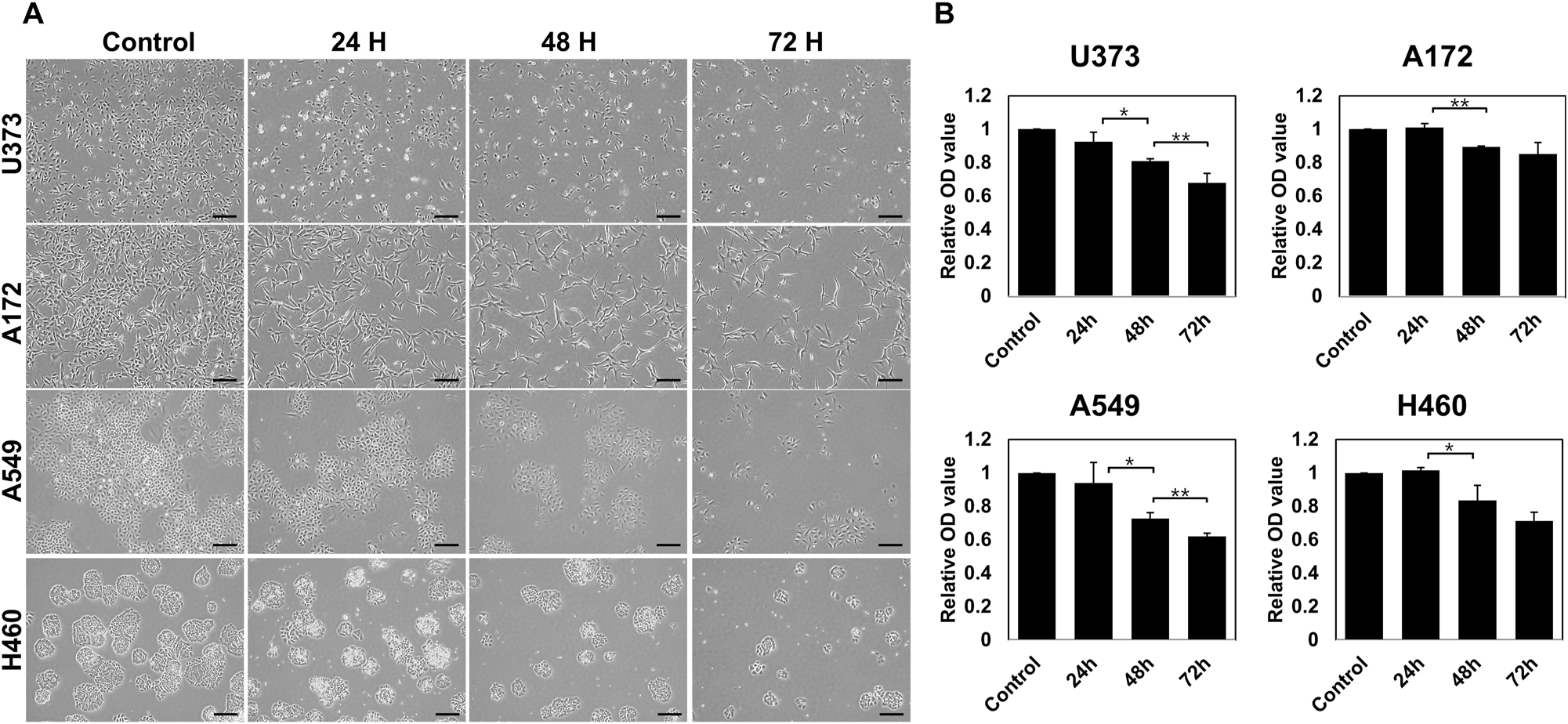 Figure 2: 
Effects of duration of mild hyperthermia at 40 °C on the viability of glioblastoma and non-small cell lung cancer (NSCLC) cell lines A549 and H460. Cells were exposed to hyperthermia at 40 °C for 24–72 h (A) Microscopic images were taken, and (B) cell viability, compared with control cells, was measured by MTT assays. Scale bar=500 μm. The values represent the means ± SDs of three independent experiments. *p<0.05, **p<0.01.
