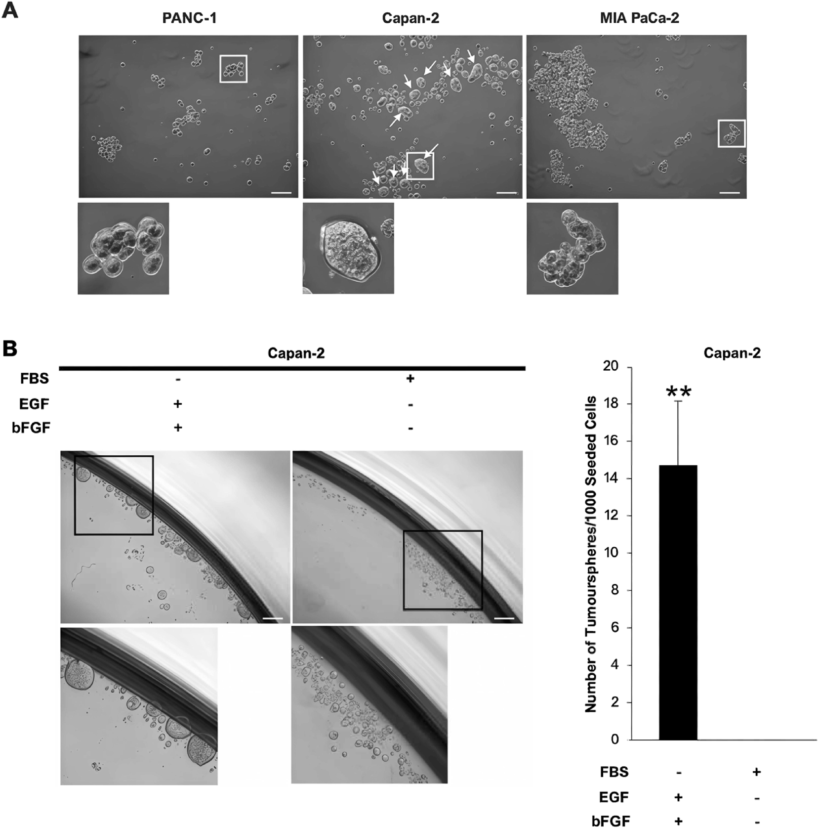 Figure 2:
Tumoursphere formation of KRAS-driven PDAC cell lines in vitro. PANC-1, Capan-2, and MIA PaCa-2 cells were cultured in serum-free and non-attached conditions. (A) Representative microscopic images show single cells of Capan-2 propagated into sphere-like colonies (diameter≥60 µm), known as tumourspheres (white arrows). PANC-1 and MIA PaCa-2 cells formed loose aggregates as they grew. Capan-2 cells were also cultured in suspension using either serum-containing or serum-free medium. Scale bar=100 µm. (B) Representative microscopic images of Capan-2 cells in either culture on the day post-seeding. The bar chart shows the number of tumourspheres that arose from 1,000 Capan-2 cells, which is expressed in mean ± s.d. (n=3 independent experiments). 10 % FBS significantly reduced tumoursphere formation and self-renewal of Capan-2 cells. Statistical significance of the difference between serum-containing and serum-free cultures was analysed by SPSS independent-samples t-test (**p<0.01). Scale bar=100 µm. bFGF, basic fibroblast growth factor; EGF, epidermal growth factor; FBS, foetal bovine serum.