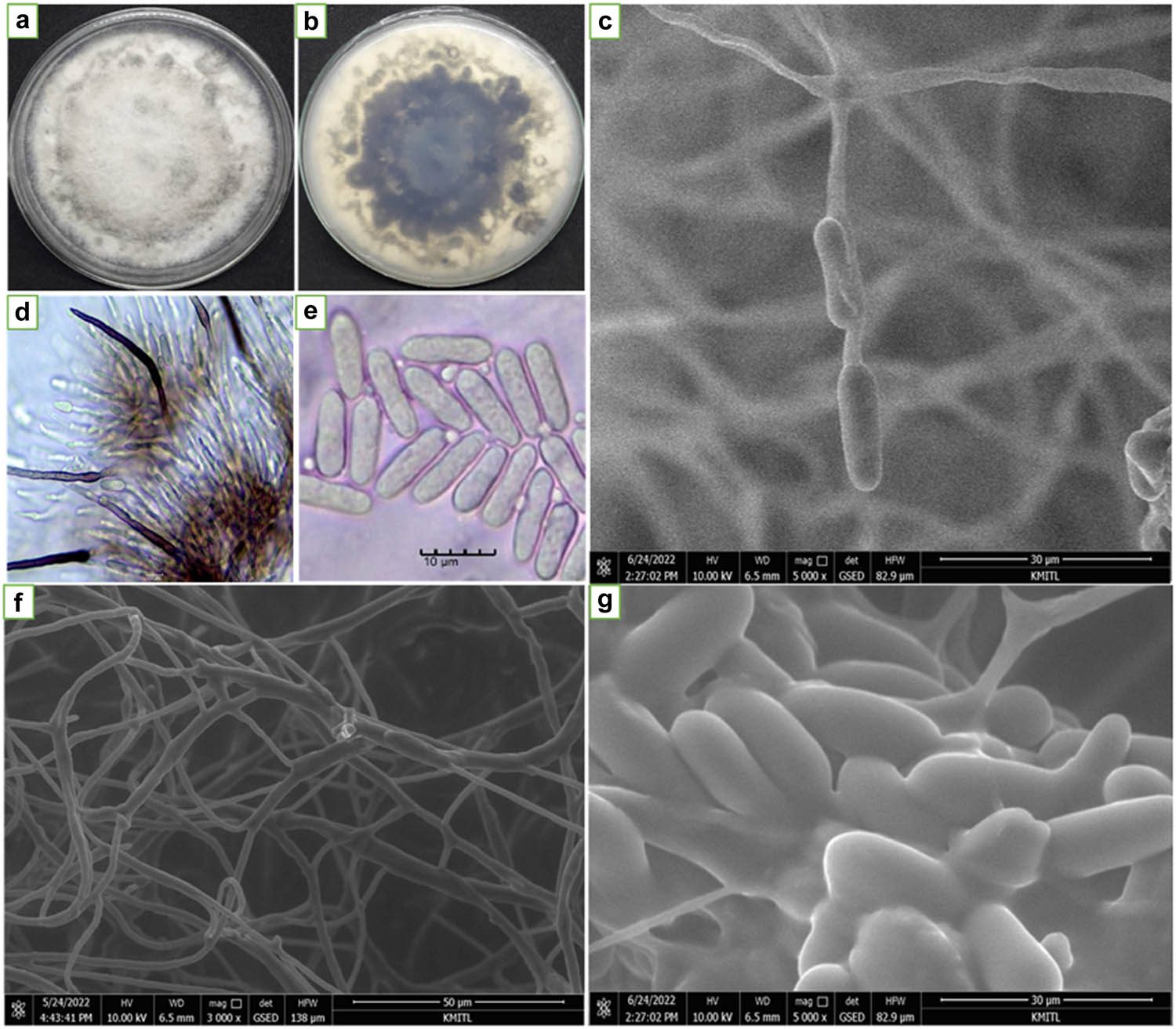 Figure 1 
                  Colony growth patterns and the general characteristic of C. gloeosporioides C01. (a) Colony pattern on PDA; (b) colony pattern on PDA upside down; (c and d) setae conidiophores; (e and g) conidia and (f) hyphal. Parts d and e were observed under light compound microscope (scale bar 10 µm, 40× magnification) and c, f, and g were observed using SEM.
               