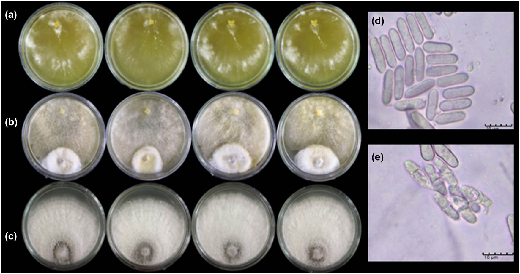 Figure 6 
                     Dual culture test of T. hamatum K01 against C. gloeosporioides C01. (a) T. hamatum K01; (b) dual culture plates of T. hamatum K01 versus C. gloeosporioides C01; (c) C. gloeosporioides C01; (d) normal conidia produce; and (e) abnormal conidia produce of C. gloeosporioides C01 caused by T. hamatum K01.
                  