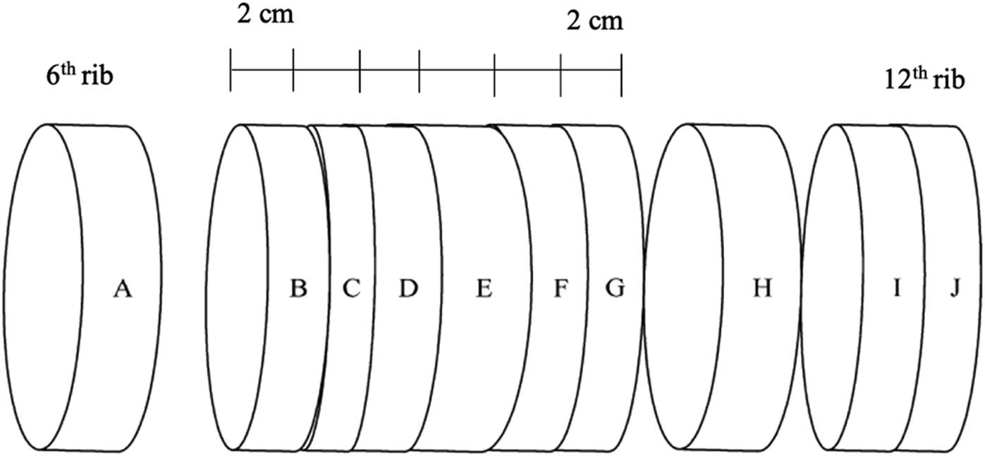 Figure 1 
                  Sampling of longissimus dorsi muscle [38].
               