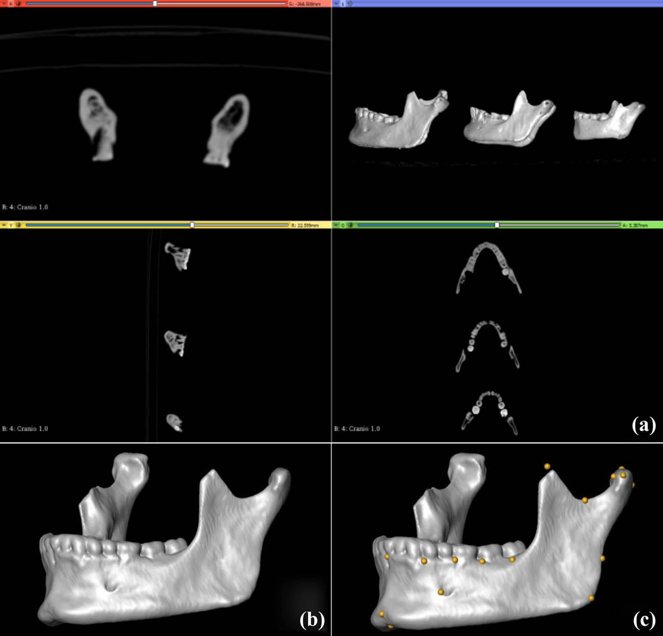 Figure 2
Visualisation of CT scan slices (a), ensued by rendering (b), and landmarking of individual specimens (c). Note that C shows the location of present and estimated missing (e.g., in the coronoid process) landmarks.