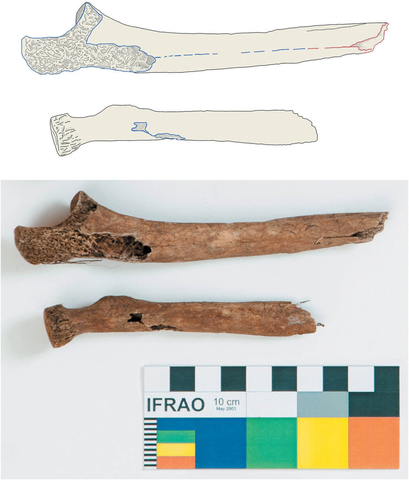 Figure 4 
                     Individual 1♀, posterior-lateral view of the ulna (top) and posterior view of the radius (bottom). The borders of the fractures on each bone are highlighted in red. Source: this work.