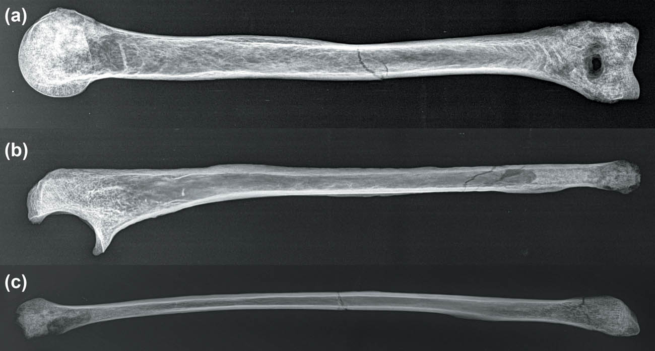 Figure 5 
                     (a–c) Show radiographic plates. (a) Individual 1♀, frontal view of left humerus, fracture on medial diaphysis. (b) Individual 2♂, lateral view of right ulna, fracture on distal diaphysis. (c) Individual 2♂, anterior view of left fibula, fracture on medial diaphysis. Source: this work.