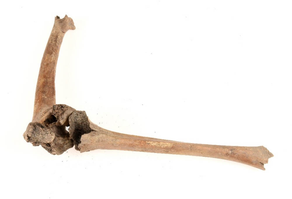 Figure 5 
               The femoral fracture in grave 2399 with the tibia repositioned to show the 45-degrees angulation. Photo: Nelly Hercberg, Cultural Museum in Lund.
            