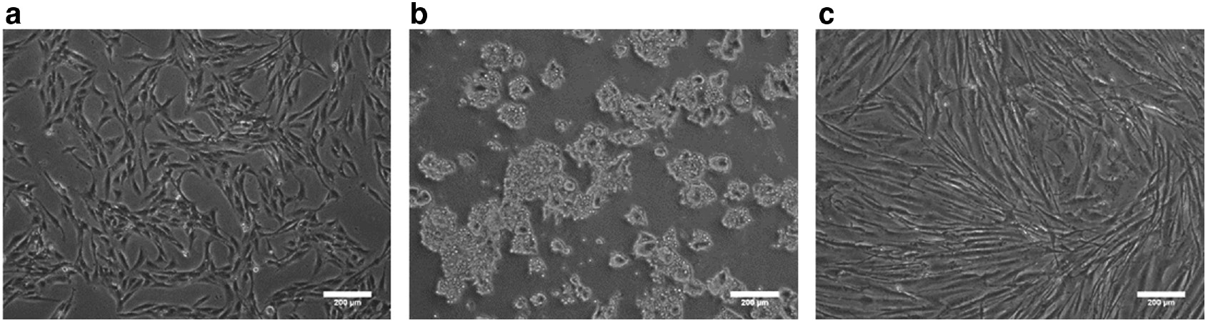 Fig. 2: Optical images of cells on TCPS. (a) Mesenchymal-derived stem cells 3A6. (b) Cancer cells SW620 (c) Fibroblasts Hs68. Scale bar=200 μm.