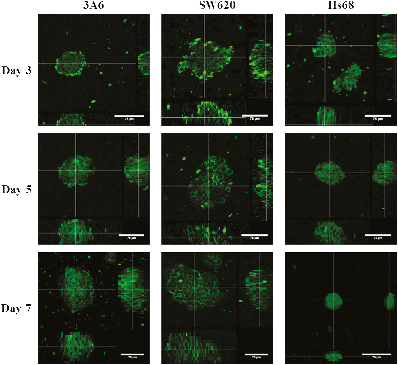 Fig. 4: Confocal immunofluorescence images of CD44 expressions of cell spheroids on chitosan-coated surfaces during a 7-day cultured period. The center images are the xy planes, and the images below and right are xz and yz planes. Scale bar=75 μm.