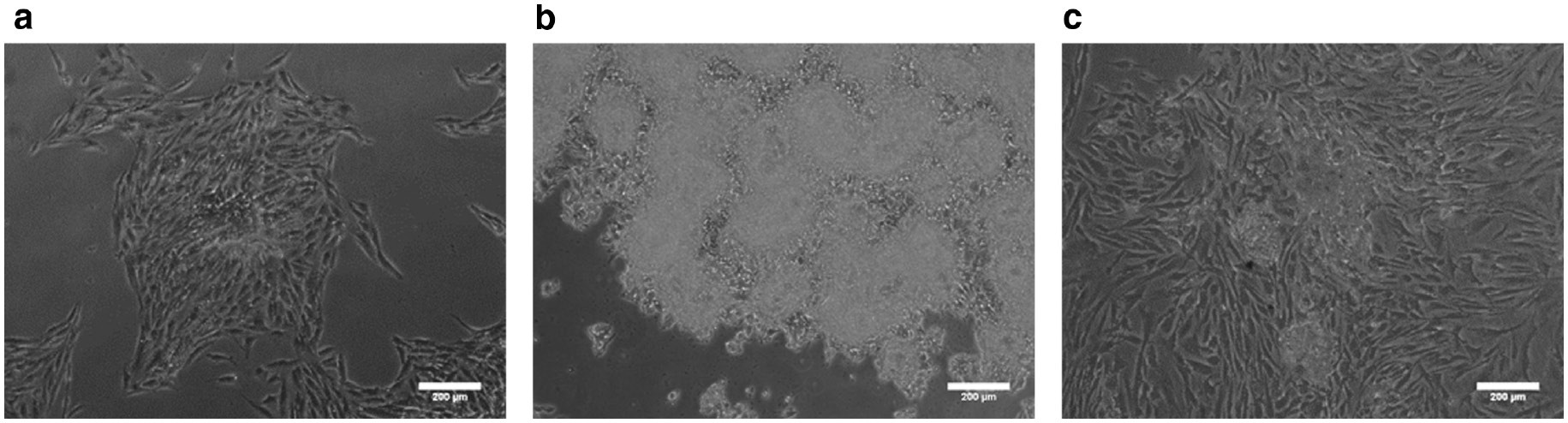 Fig. 7: Optical images of reseeding cells on TCPS. Cells cultured on chitosan-coated surfaces for 3 days and reseeded to TCPS for 3 days. (a) 3A6. (b) SW620. (c) Hs68. Scale bar=200 μm.