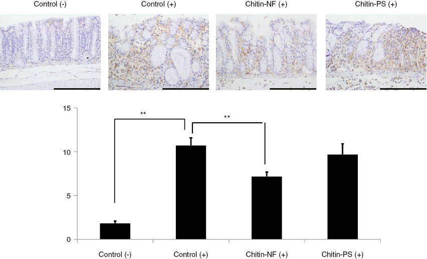 Fig. 7: To evaluate the effects of α-chitin nanofibrils on NF-κB of the colon epithelium, immunohistochemical detections of NF-κB were performed. The results of immunohistochemical detections of NF-κB were shown. In the control (+) and chitin-PS (+) group, much positive areas of NF-κB in epithelium cells were observed. In the α-chitin nanofibrils (+) group, positive areas of NF-κB in epithelium cells were markedly decreased. To evaluate the effects of α-chitin nanofibrils on NF-κB activations in the epithelium cells, we performed digital image analysis. The percentages of positive areas of NF-κB in epithelium cells are shown in this slide. In the α-chitin nanofibrils (+) group, the score was significantly lower than that in the control (+) group (p < 0.05).