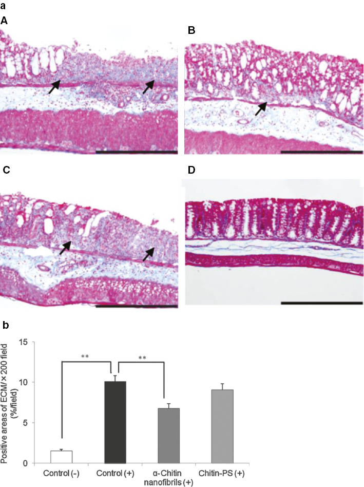 Fig. 8: Effects of α-chitin nanofibrils on colon fibrosis in a mouse model of DSS-induced acute UC.(a) Masson’s trichrome staining results are shown. Data are presented for one mouse each from the control (+) (A), -chitin nanofibrils (+) (B), chitin-PS (C), and control (–) groups. Areas of collagen deposition are indicated by arrows. Bar = 200 μm. (b) Data represent the means ± S.E. of 30 fields/×100 field in each group. The statistical analyses were performed with a Steel–Dwass test. *p < 0.05, **p < 0.01. Reprinted with permission from ref. [62].