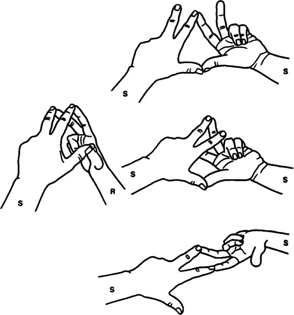 Fig. 5: With three interaction points between selector and selectand, enantioselective discrimination is possible, as in the case between a left (S) and a right (R) hand. With two left hands, only two interactions are possible [19]. Transferred to molecules, the RS complex is more stable than the SS complex. In chromatography (and in this very case), the S enatiomer would be eluted first.