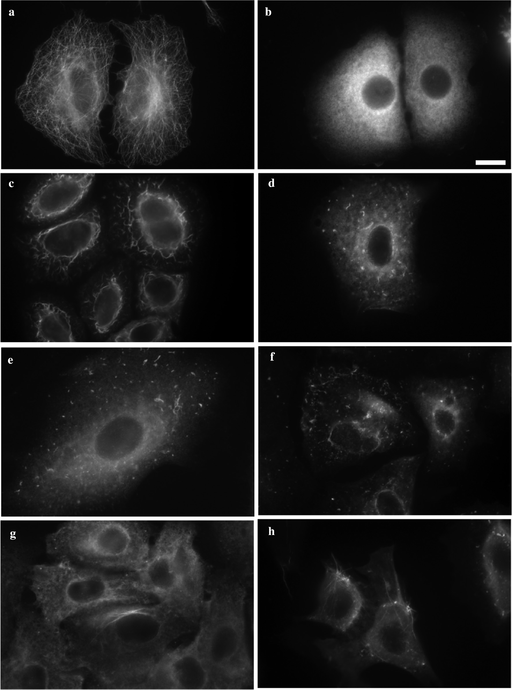 Fig. 3:
Fluorescence microscopy of MTs and tubulin structures in human lung carcinoma cells A549 treated with: (a) 0.5% DMSO (negative control) – intact microtubules; (b) 1 μM of colchicine (positive control) – depolymerization of MTs, no clustering; (c) 1 μM of tubuloclustin (1) – long wavy clusters; (d) 10 μM 2b – point-like and short wavy clusters; (e) 10 μM 2c – point-like and short wavy clusters; (f) 100 μM 2d – point-like and short wavy clusters; (g) 10 μM 2a – tiny aggregates and long tubulin filaments; (h) 100 μM 2a – small clusters and many long tubulin fibrils. Bar 10 μm.