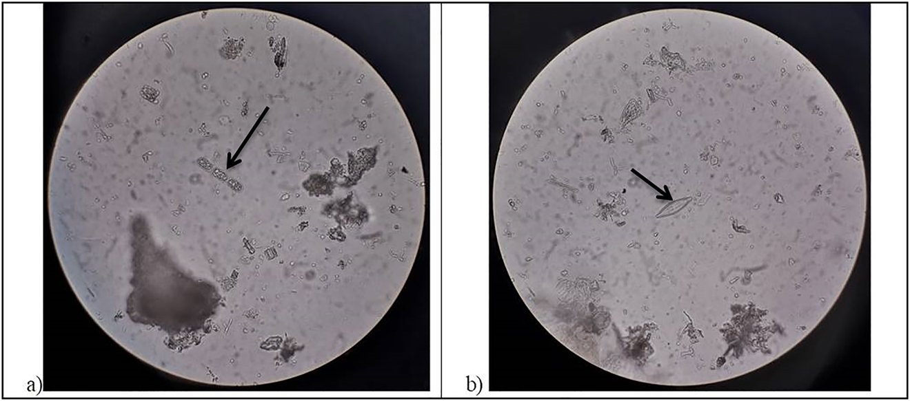 Fig. 2: 
Photos of phytoplankton representatives found in the snow of the Onega Bay of the White Sea: a) Melosira arctica, b) Navicula sp.
