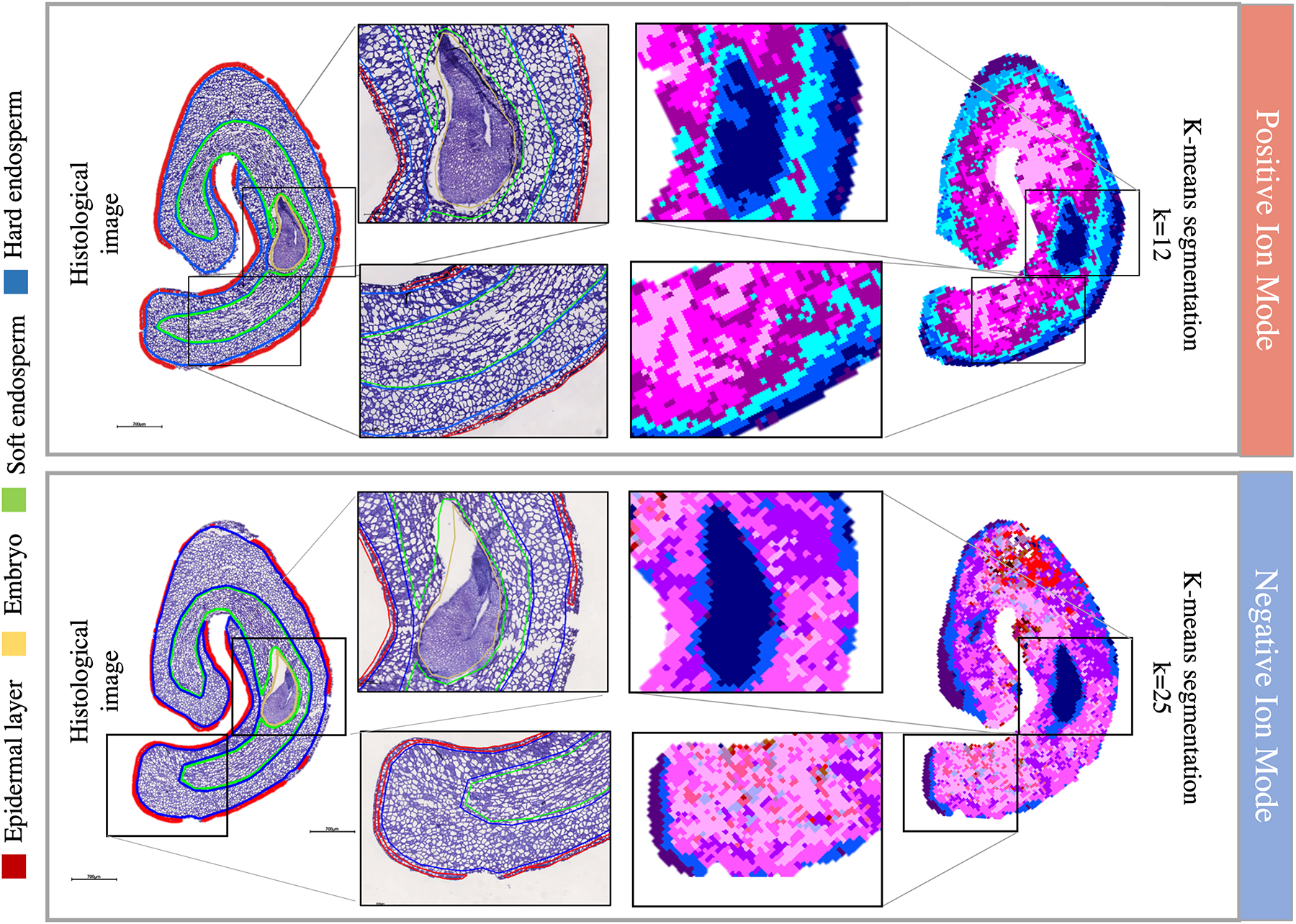 Fig. 2: 
Comparison of TBO stained C. arabica sections and spatially segmented MALDI-MSI with k-means algorithm in positive and negative ion mode. Each cluster defined by the k-means algorithm is represented by an arbitrary colour.