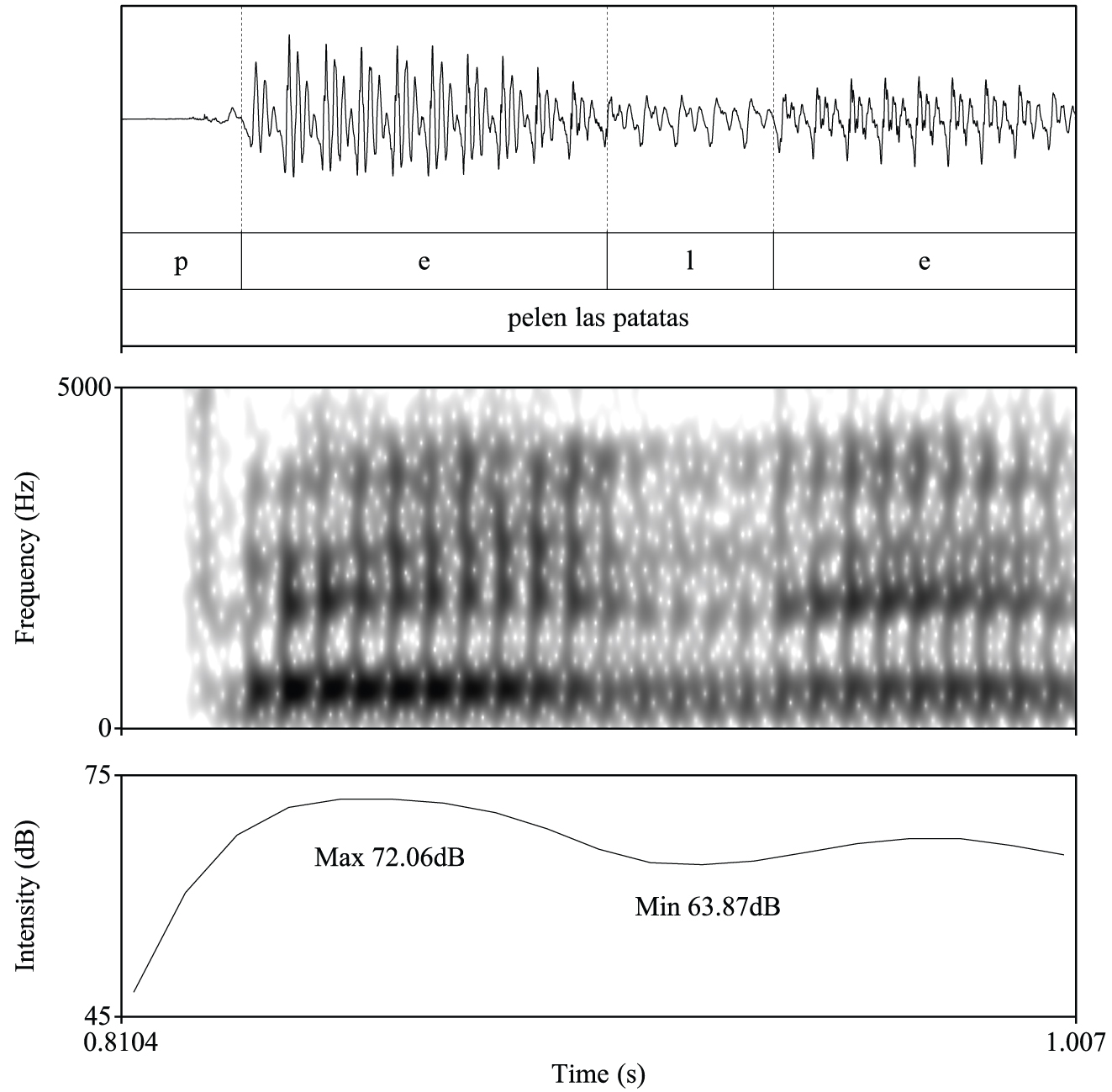 Figure 1:
Segmentation of /l/ from the test word pelen, as produced by SpM5. Minimum and maximum intensity values used for the calculation of IntDiff are also shown on the intensity contour in the bottom panel.