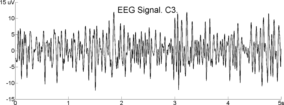 Figure 1 Five seconds of EEG signal in a Motor Imagery Brain Computer Interface experiment from channel C3.(X axis in seconds and Y axis in microvolts)