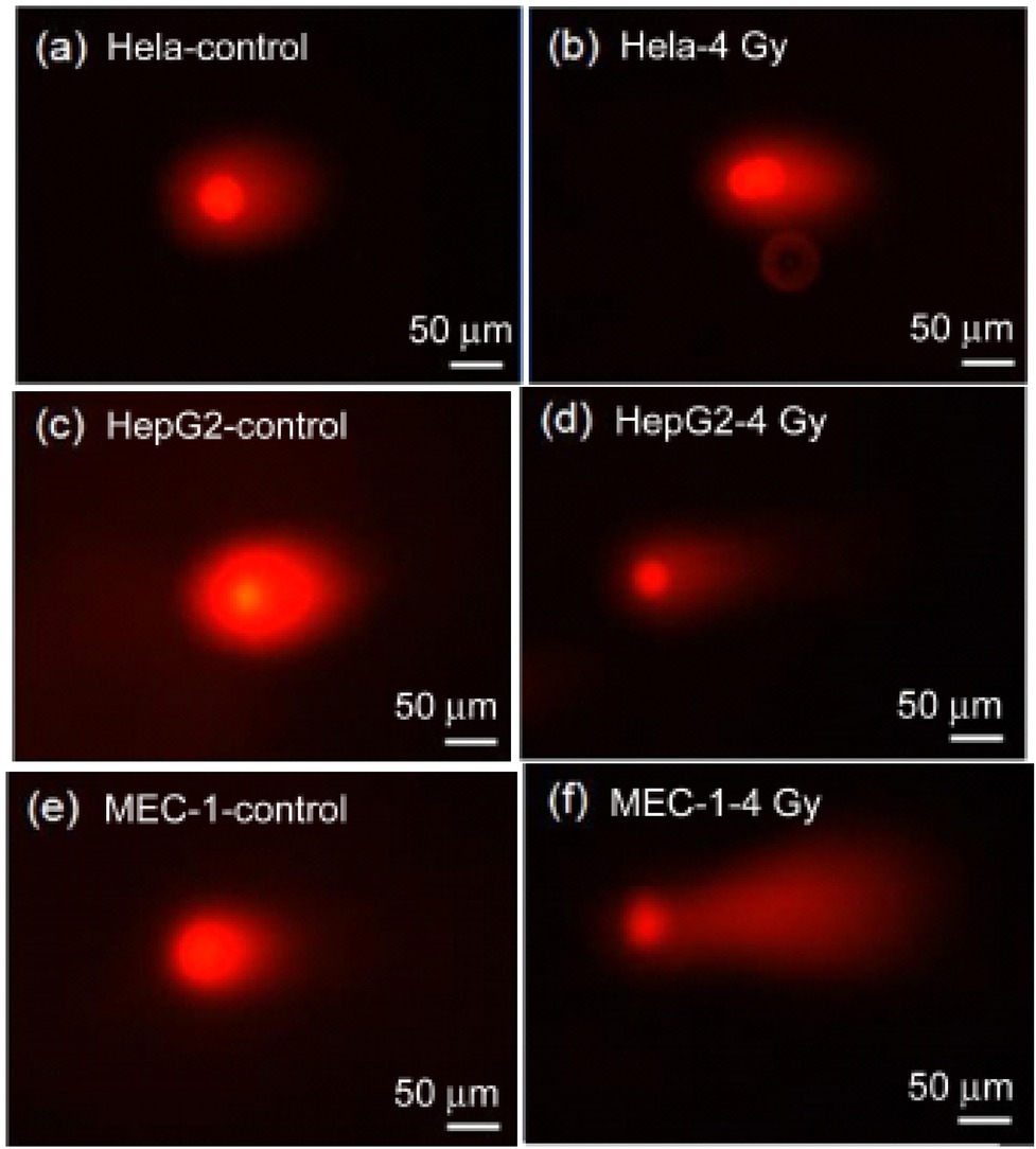 Figure 6 Neutral comet electrophoresis of 4H cells after X-ray irradiation
