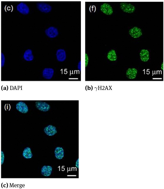 Figure 7 HHepG2 hepatoma cells X radiation of 8 Gy group after 0.5 h focus image formation