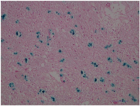 Figure 1 Human brain, globus pallidus. Blue dyed deposits correspond to the presence of Fe(III) probably around glial cells. Scale bar = 100 μm.