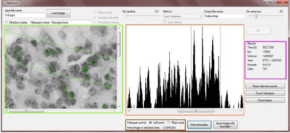 Figure 3 Displaying results in our program: The part in the green rectangle shows segmented iron cells and user selected region. Histogram with two columns selected is displayed in the orange rectangle. Two red columns represent two green lines in the image in the left window. Numerical results are in the purple rectangle. The percentage of segmented pixels in the region between the two green lines is written in the brown rectangle.