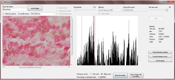 Figure 4 Results: Final segmentation and corresponding histogram