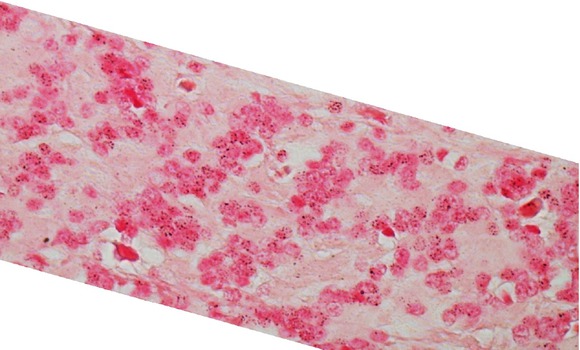 Figure 6 The selected part of original image after application of enhancement.