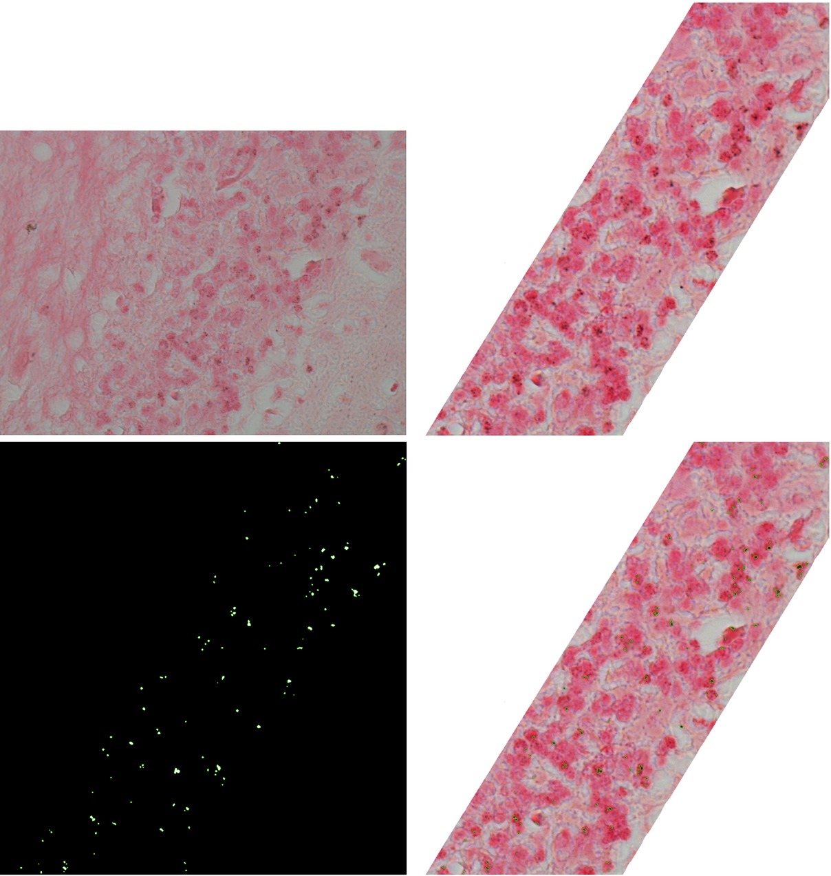 Figure 11 Results: In the upper row on the left hand side there is the original image, on the right hand side there is the cut and enhanced image and in the bottom row there are the results of segmentation in a form of a binary image on the left hand side and an image with highlighted segmentation on the right hand side.