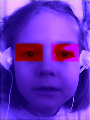 Figure 5 Region proposal by the SVM - Real model which classifies the eyes from the video