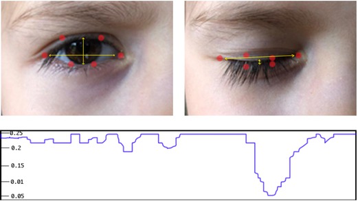Figure 7 Calculated Facial Landmarks of eye (red points - top), p. Blink recognition for with Soukupova et al. method [27]. Bottom Plotting the eye aspect ratio over time.