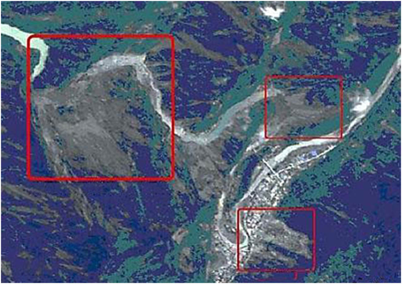 Figure 3 
                  After enhancement.
               