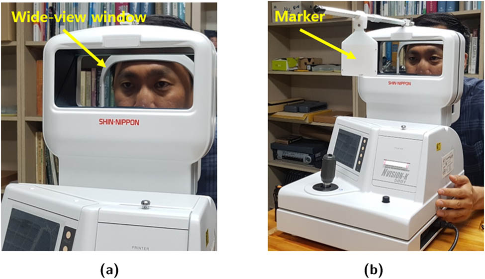 Figure 5 
                  N-vision K5001 autorefractor: (a) wide-view window and (b) attached near marker.
               