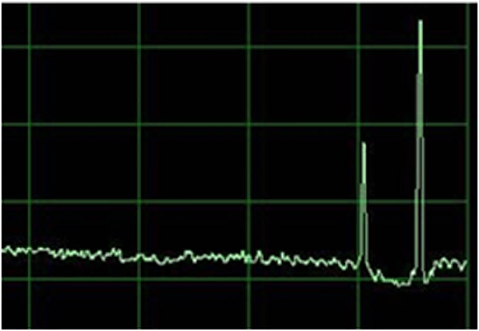 Figure 1
Two output signals on an oscilloscope after a supersonic projectile passes through the light curtain.