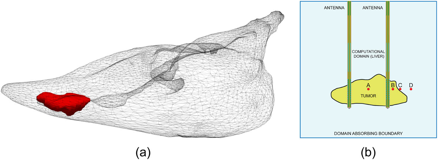 Figure 2 
                  A schematic view of (a) 3D model of the liver (gray surface) and tumor (red surface) [34] and (b) planar cross-section of the 3D geometry of the problem with two multi-slot antennas with control points.
               