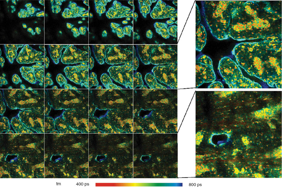 Figure 10 Pig skin stained with methylene blue. Z-stack recorded by mosaic FLIM with 16 planes from 0 to 60 μm from top of sample; each plane with 512×512 pixels, 256 time channels. Amplitude weighted lifetime of double exponential decay. Plane 8 (30 μm) and plane 16  (60 μm) are shown magnified and with individually adjusted intensity scale.