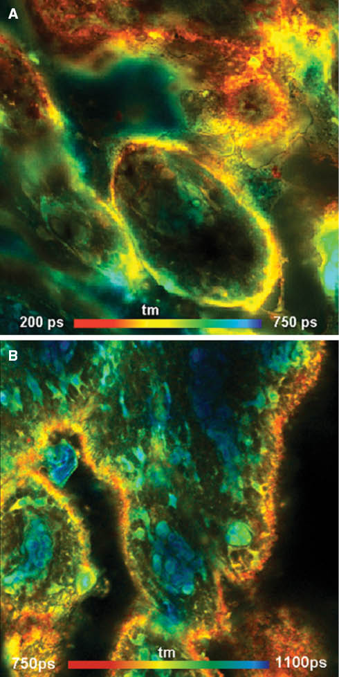 Figure 6 Pig skin sample stained with ICG (A) and DTTCI (B). A Zeiss LSM 710 NLO multiphoton microscope and a Ti:Sa laser were used for one-photon excitation at a wavelength of 780 nm. The photons were detected by a HPM 100-50 hybrid detector (Becker & Hickl; detection wavelength range 800–900 nm), and the FLIM data were recorded by a the Simple-Tau 150 FLIM system (Becker & Hickl GmbH). Lateral size of the images 212×212 μm, depth about 30 μm from surface. Note the high contrast of the images.