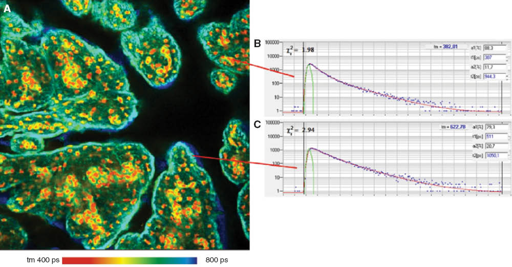 Figure 7 Pig skin stained with methylene blue. Lifetime image (A) and decay curves in characteristic spots of the image (B and C). Fit with double-exponential model, amplitude-weighted lifetime. FLIM images were obtained after two-photon excitation at 1200 nm. Data analysis with SPCImage (Becker & Hickl GmbH). FLIM data format 512×512 pixels, 256 time channels.