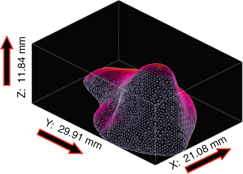 Figure 6: The *.stl model dimensions of the maxillary sinus.