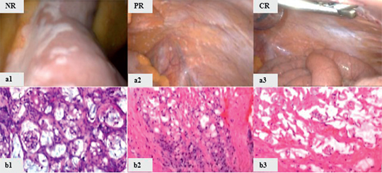 Figure 2: Pathological response after PIPAC.