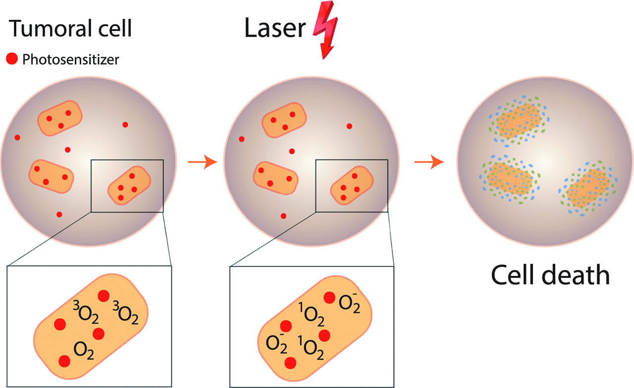 Figure 1: photodynamic therapy: mechanism.